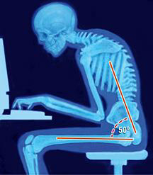 Can poor posture affect your height? — SpinalCare Sydney Olympic